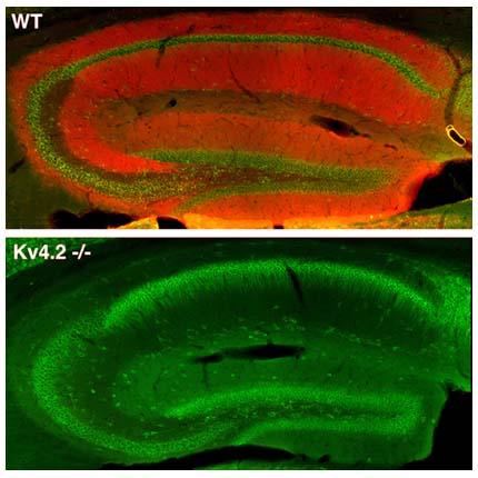 Fluorescent hippocampal sections: WT with red and green layered staining; Kv4.2−/− mostly green