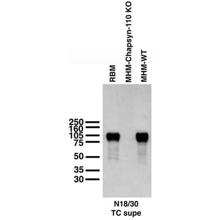 Western blot graphic showing three lanes with prominent ~75 kDa bands
